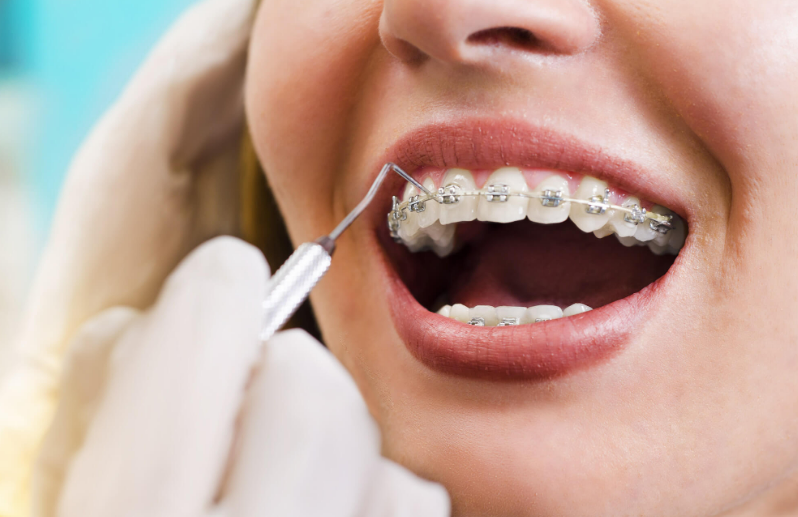 Early Signs You May Need Orthodontic Care From Your General Dentist