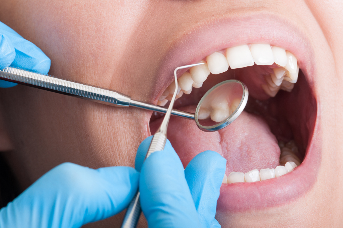 How Cosmetic Dentistry Can Fix Chips, Gaps, And Stains